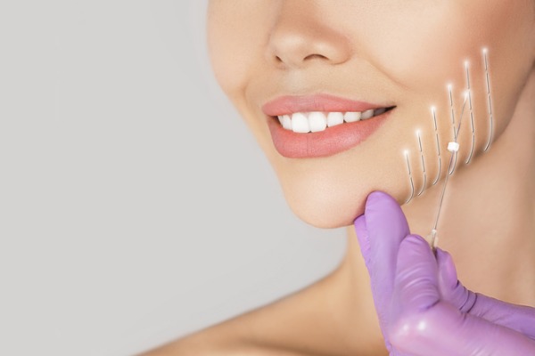 Een gummy smile-behandeling: de laag-invasieve cosmetische procedure die lachrimpels stopt